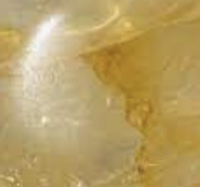 Yellow Hematoide