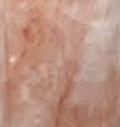 Red Hematoide